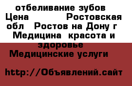 White Smile отбеливание зубов › Цена ­ 3 000 - Ростовская обл., Ростов-на-Дону г. Медицина, красота и здоровье » Медицинские услуги   